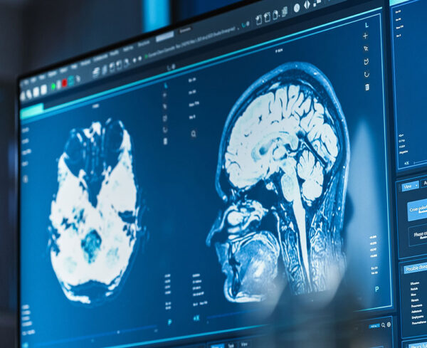 looking at a screen of a medical device that is x raying someones brain