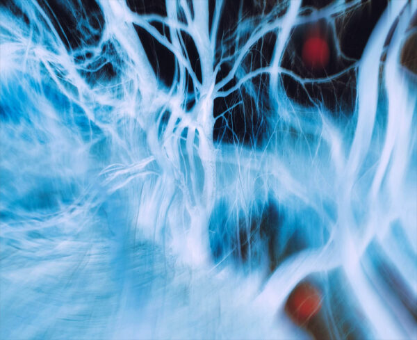 blue faded lines on a black background, mimicking the look of veins