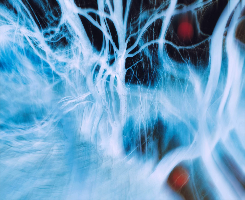 blue faded lines on a black background, mimicking the look of veins